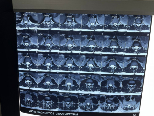 VARUN-MRI-2-2.jpg