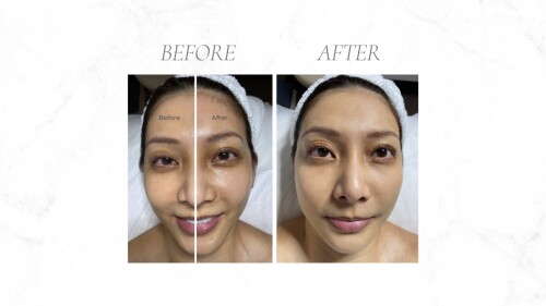 Lash-in-bloom-Lash-Treatment--Eyelash-Extension-Procedure.jpg