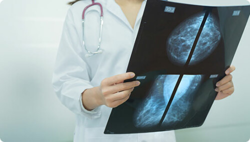 Breast-Cancer-Screening-and-Diagnosis-by-Melanie-Seah.jpg