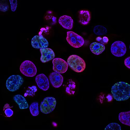 Stem-Cell-Therapy.jpg